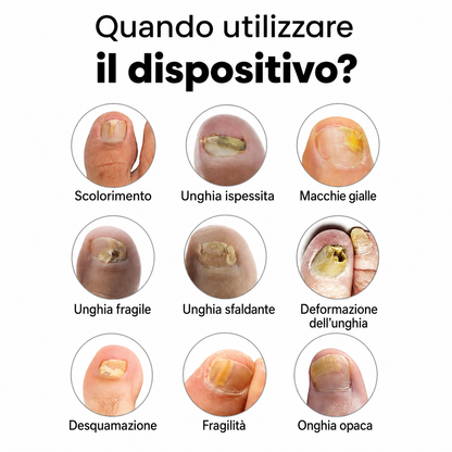 Apparecchio OrthoMonverio